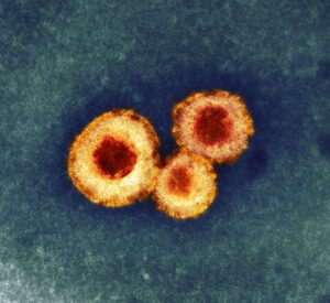 Human Metapneumovirus, what is it? - TARLAKENYO